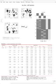 Юлия, spv,spm,10v,10mm,змішувала в рівних пропорціях з рідним окисником матрікс 2,7. Chapter 6 Running The First Level Analysis Andy S Brain Book 1 0 Documentation
