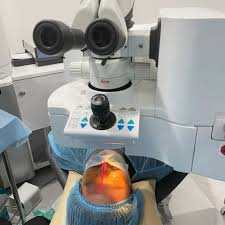 lasik eye surgery in singapore the
