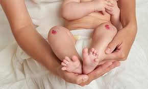 baby knee pads best way to prevent