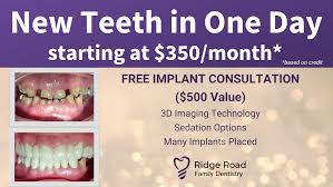 cost of dental implants best implant