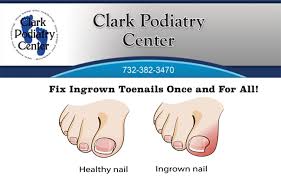 fix ingrown toenails once and for all