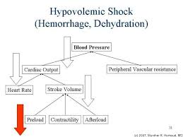 Nursing case study hypovolemic shock SlideShare Nursing Mnemonics and Tips