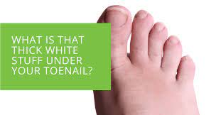 thick white stuff under your toenail