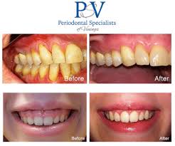 periodontics periodontist and dental