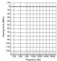 Blank Audiogram Chart Blank Audiogram Graph Cake Ideas