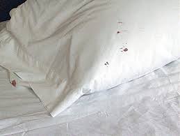 Key Signs And Symptoms Of Bed Bugs