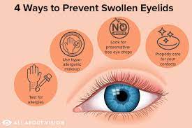 swollen eyelid treatment and prevention