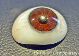 artificial eye prosthetic eye eye