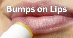 ps on the lips causes symptoms