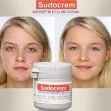acne e skin and acne scars
