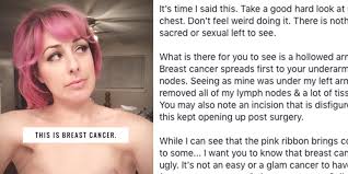 this t cancer survivor shared a