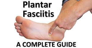 plantar fasciitis our complete guide