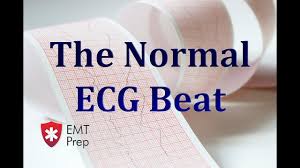 The Normal Ecg Beat Emtprep Com