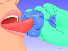 Image result for images for a bitten tongue