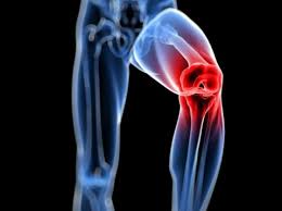 knee pain by addressing its alignment