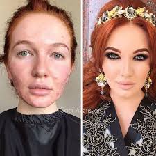 after an accident or illness makeup