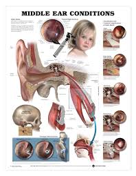 Middle Ear Conditions Such As Pressure Or Infection Which
