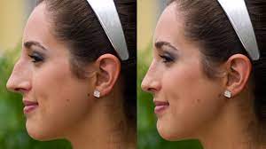 Maybe you would like to learn more about one of these? Eschewing The Nose Job In Image Conscious L A The Forward
