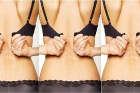Low back bra strap strip (tali bh backless). 5 Tanda Memakai Bra Yang Salah Ukuran