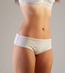 home remes to reduce stretch marks