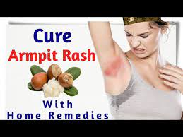 armpit rash with home remes