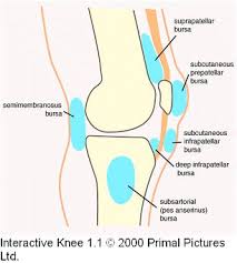 knee bursitis