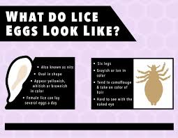 head lice eggs