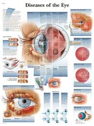 Pin By Hussein Alhammami On Eye Conditions Medical Posters