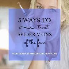 5 ways to treat spider veins of the face