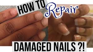damaged nails after acrylics