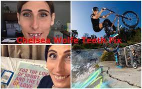 She put out her words for her historic achievement in an instagram post. Chelsea Wolfe Teeth Fix Before And After Olympics Bmx Rider And More