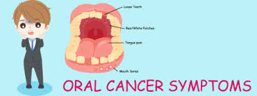 floor of the mouth cancer causes