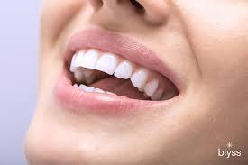 how long do teeth whitening last