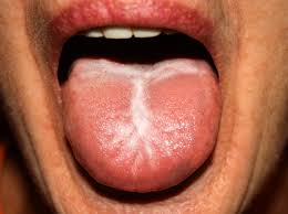 In this article, learn about six causes of a swollen roof of the mouth, and possible treatment or home remedies. Bump On The Roof Of The Mouth 12 Causes