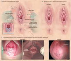 Female Prepubertal Genital Anatomy Download Scientific Diagram