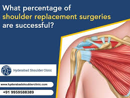 shoulder replacement surgeries