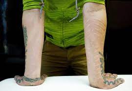 Similar to tattoos, scarification is a process is which the skin is. Scarification The Extreme Body Art That S Making A Mark The Globe And Mail