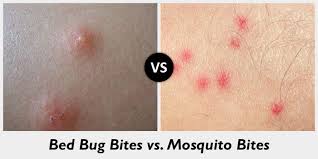 read about bed bug bites top
