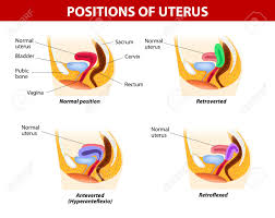 Diagram For Variants Of Uterine Position Normal Uterus Rests