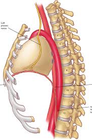 The rib cage is formed by the sternum, costal cartilage, ribs, and the bodies of the thoracic vertebrae. Lateral View Of The Left Diaphragm Download Scientific Diagram