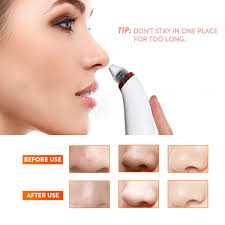 pore cleaner acne pimple removal vacuum