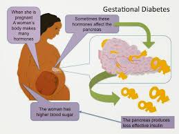 Cheap Custom Papers Writing Service   Expert Essay Writers  case     SlideShare The effect of IGF  on developing gestational diabetes mellitus 