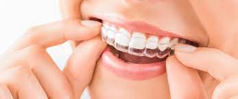 Do i really need to wear a retainer forever for that purpose? After Invisalign How Many Hours A Day Will I Need To Wear A Retainer General Endodontist And Cosmetic Dentist Laurel Md