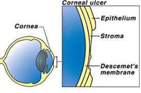 Ulcers are usually detected using a special dye. Corneal Ulcers City Beach Vet