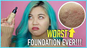 worst foundation ever for acne skin