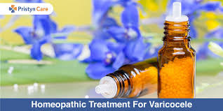 homeopathic treatment for varicocele