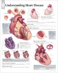 Understanding Heart Disease Chart Laminated Wall Chart