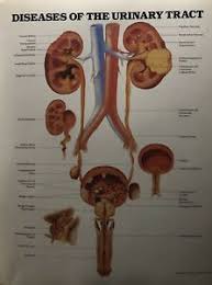 Details About Diseases Of The Urinary Tract Medical Student Poster Chart