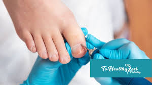 foot doctor for my ingrown toenail