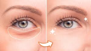eye bag remover how to get rid of eye